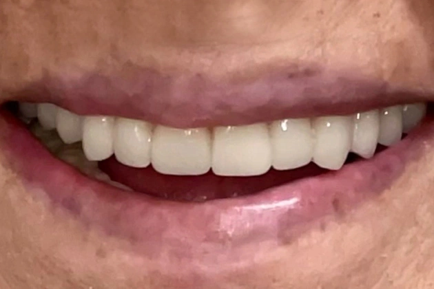 General Dentistry in Florham Park